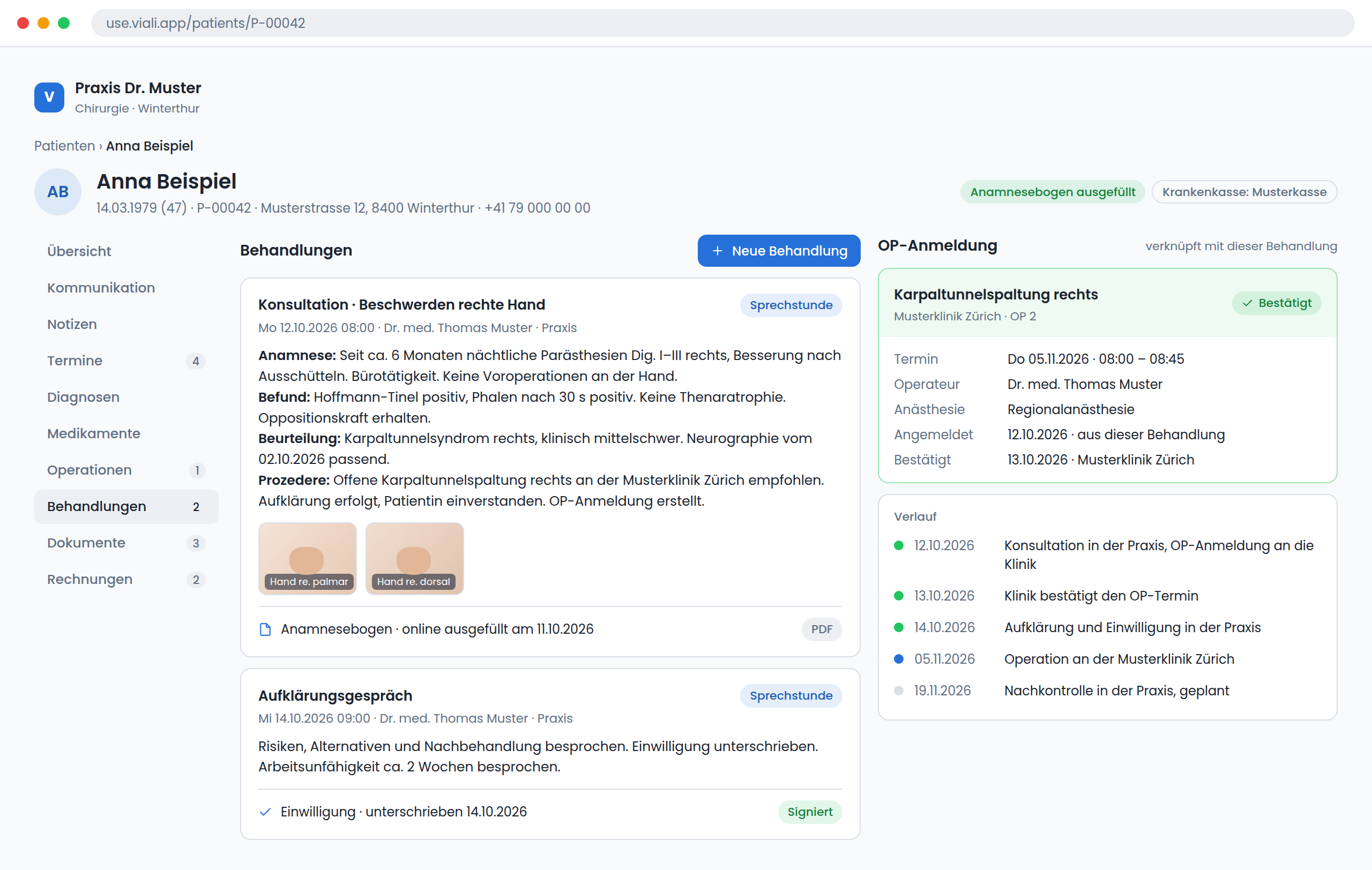 Viali Praxis: Patientendossier mit einer Konsultationsnotiz, Fotos und der verknüpften OP-Anmeldung an die Klinik